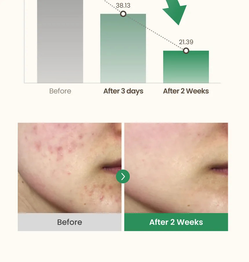 سيروم Axis-Y لتصحيح البقع الداكنة ٥٠ مل 